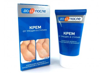 До и После (косметика)